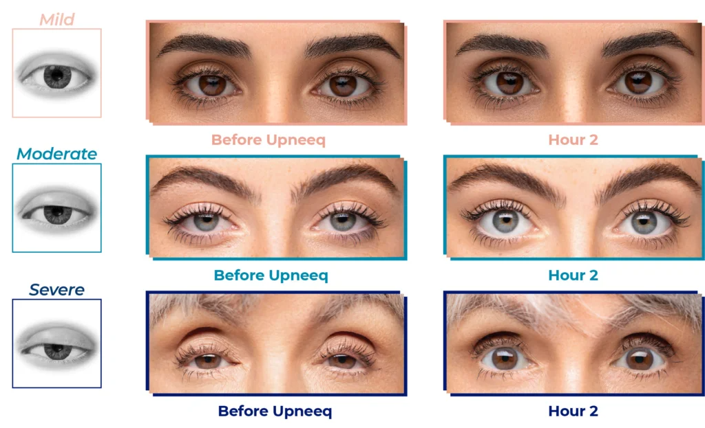 Upneeq - Renew Wellness & Aesthetics