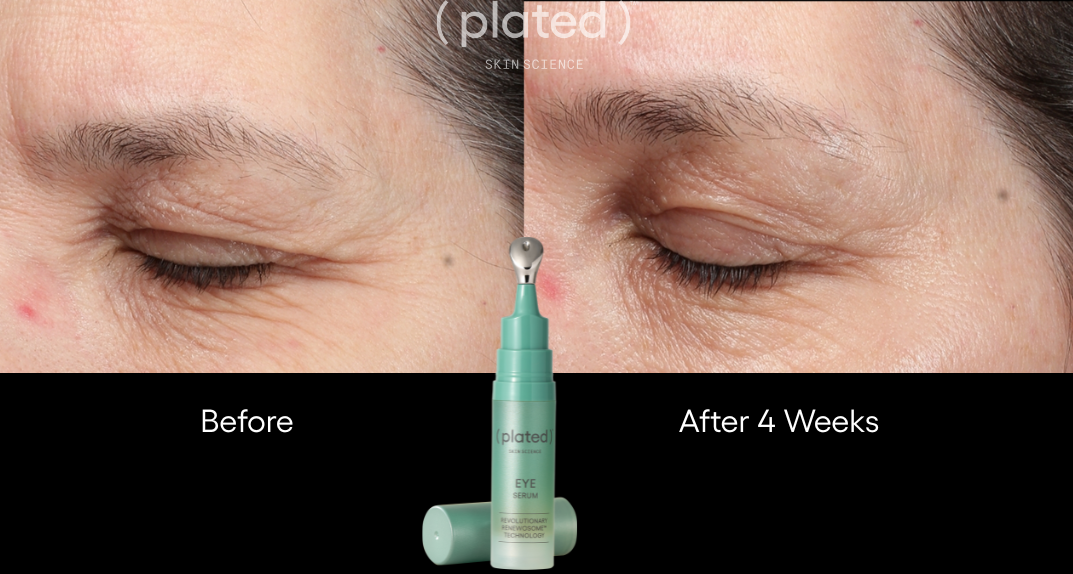 Plated Eye Serum - Renew Wellness & Aesthetics