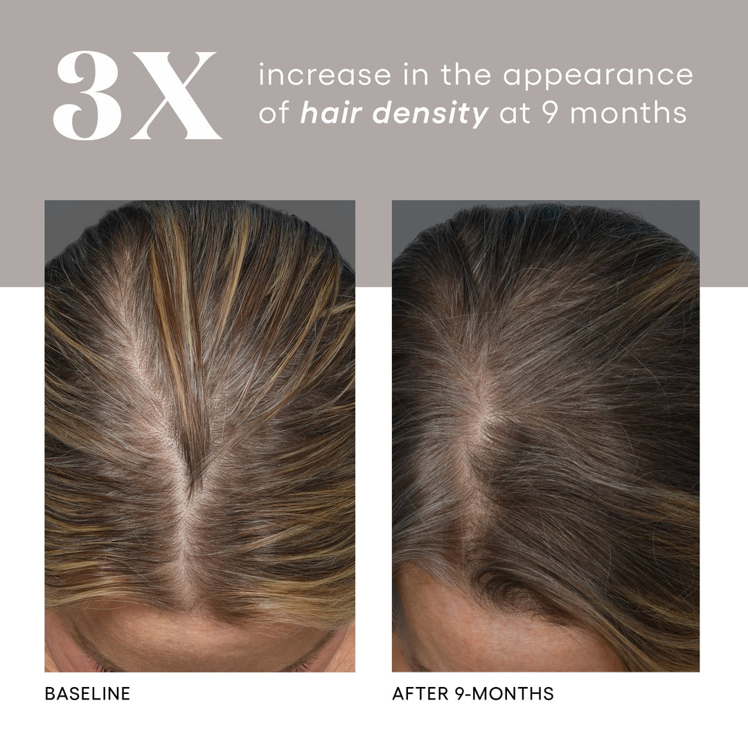 Plated Hair Serum - Renew Wellness & Aesthetics
