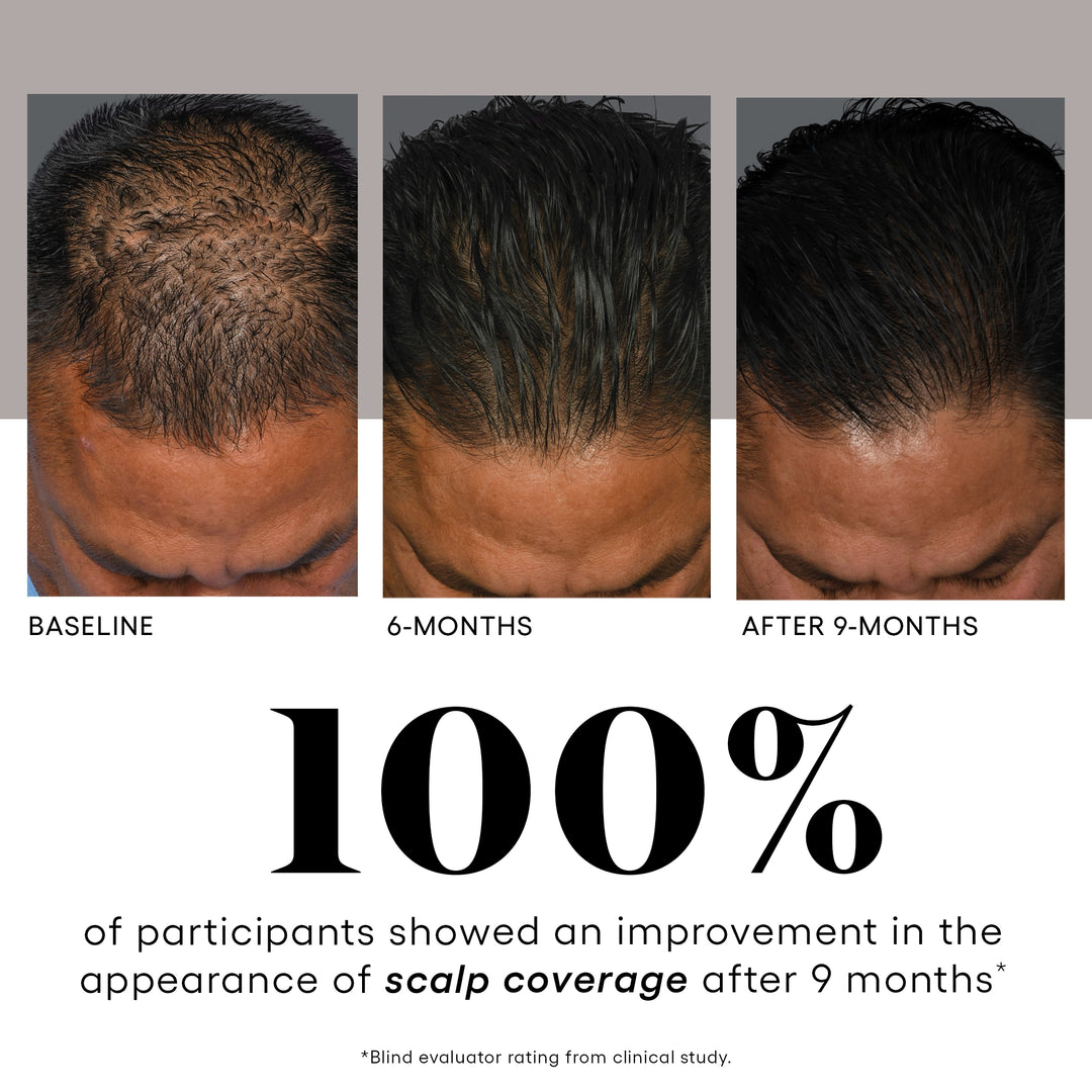 Plated Hair Serum - Renew Wellness & Aesthetics