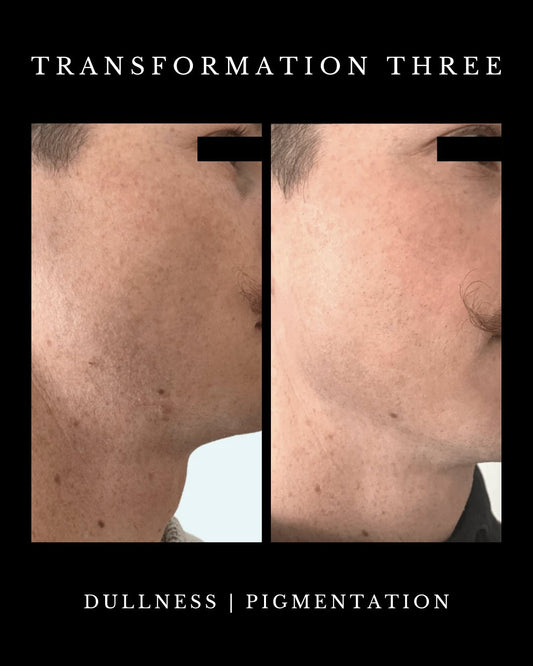 Men, do you want to age backwards FROM HOME? Your skin is 25% thicker. That means it demands treatments that work harder and penetrate deeper. The Omnilux Men Red Light Therapy Mask is FDA-approved and specifically engineered to:
💪🏼 Reduce Wrinkles
💪🏼 Minimize Eye Bags
💪🏼 Calm Post-Shave Irritation
💪🏼 Fade Dark Spots
💪🏼 Improve Skin Texture
Shop the link above! Pick-up in store or ship with UPS!
#OmniluxMen #RedLightTherapy #MensSkincare