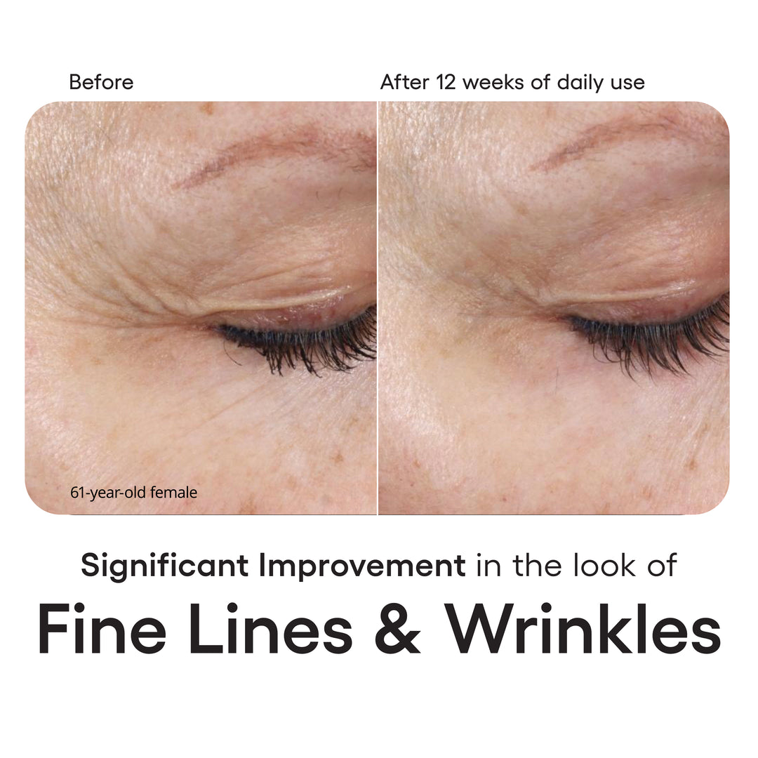 Plated Intense Serum Refill - Renew Wellness & Aesthetics