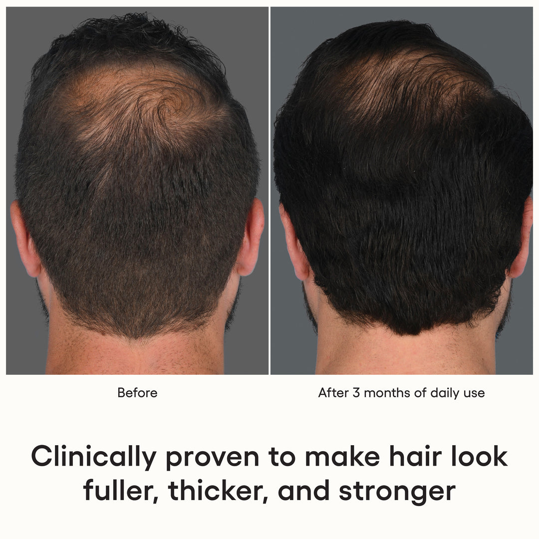 Plated Hair Serum - Renew Wellness & Aesthetics