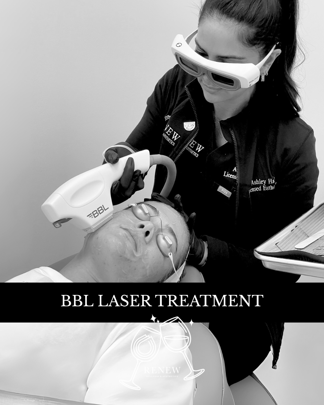 BBL Hero - Renew Wellness & Aesthetics