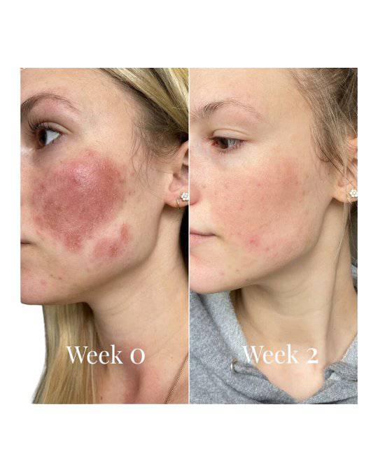 Omnilux Contour for Face LED Therapy DeviceAnti - Aging - Renew Wellness & Aesthetics