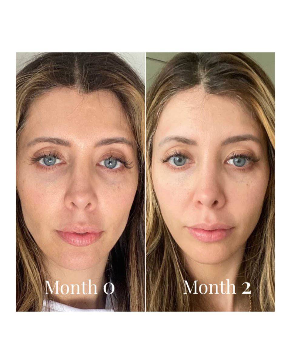 Omnilux Contour for Face LED Therapy DeviceAnti - Aging - Renew Wellness & Aesthetics