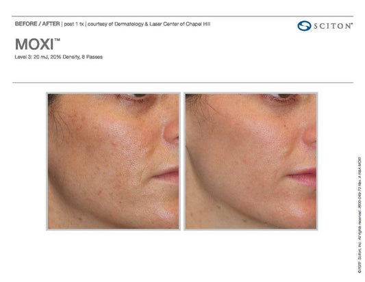 Moxi - Renew Wellness & Aesthetics