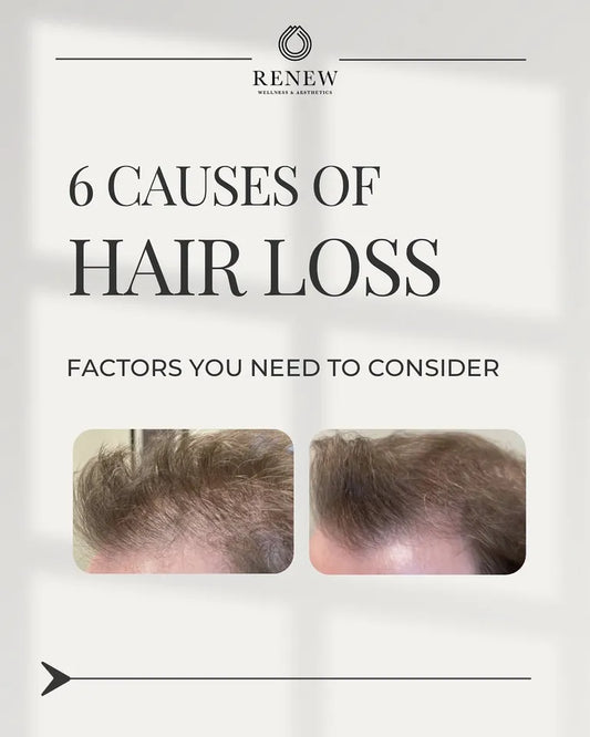 #tolstoy-video-preview-https%3A%2F%2Fvideos.gotolstoy.com%2Fpublic%2Ff00b0659-6105-4e34-b1ec-0586b7f2b7f7%2Fd52b3849-9dff-4cc5-8439-4193abd5e246%2Fd52b3849-9dff-4cc5-8439-4193abd5e246.mp4