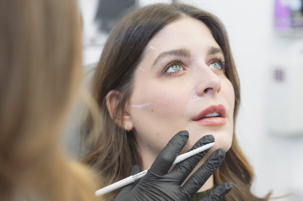 Filling You in on All Things Dermal Fillers - Renew Wellness & Aesthetics