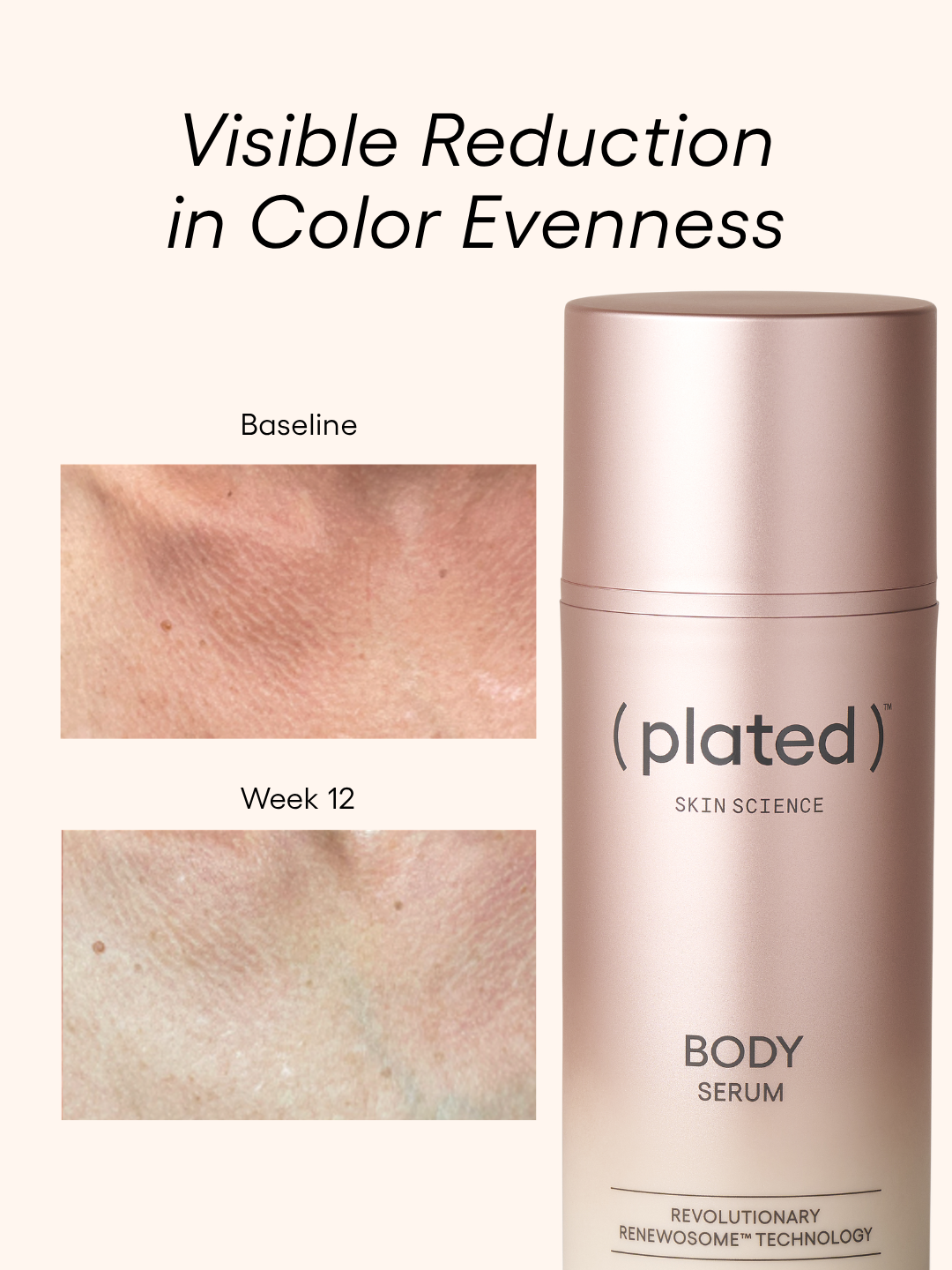 Plated Body Bundle