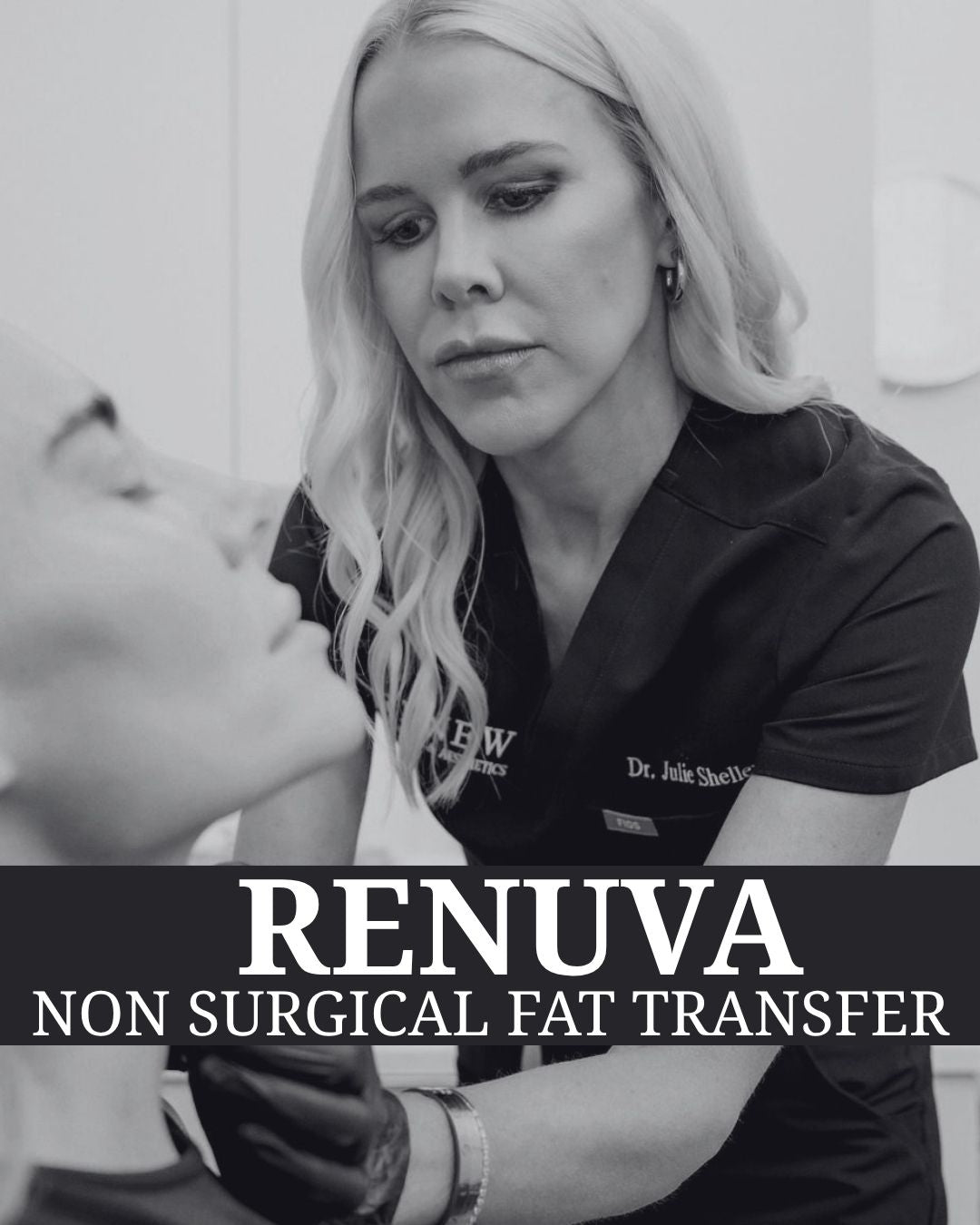 Volume Renewal - Non Surgical Fat Transfer (Renuva)