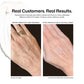 Revision Youthful Hand - Renew Wellness & Aesthetics 