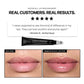 Revision YouthFull Lip Replenisher - Renew Wellness & Aesthetics 