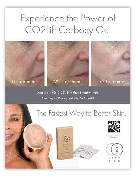 CO2Lift® Pro Carboxy Gel Mask - 1 Home TreatmentAnti - Aging - Renew Wellness & Aesthetics