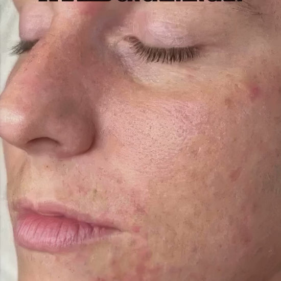 This or That: Skincare Edition! 😌

#renewoklahoma #skincare #skincareroutine #thisorthat #trend
