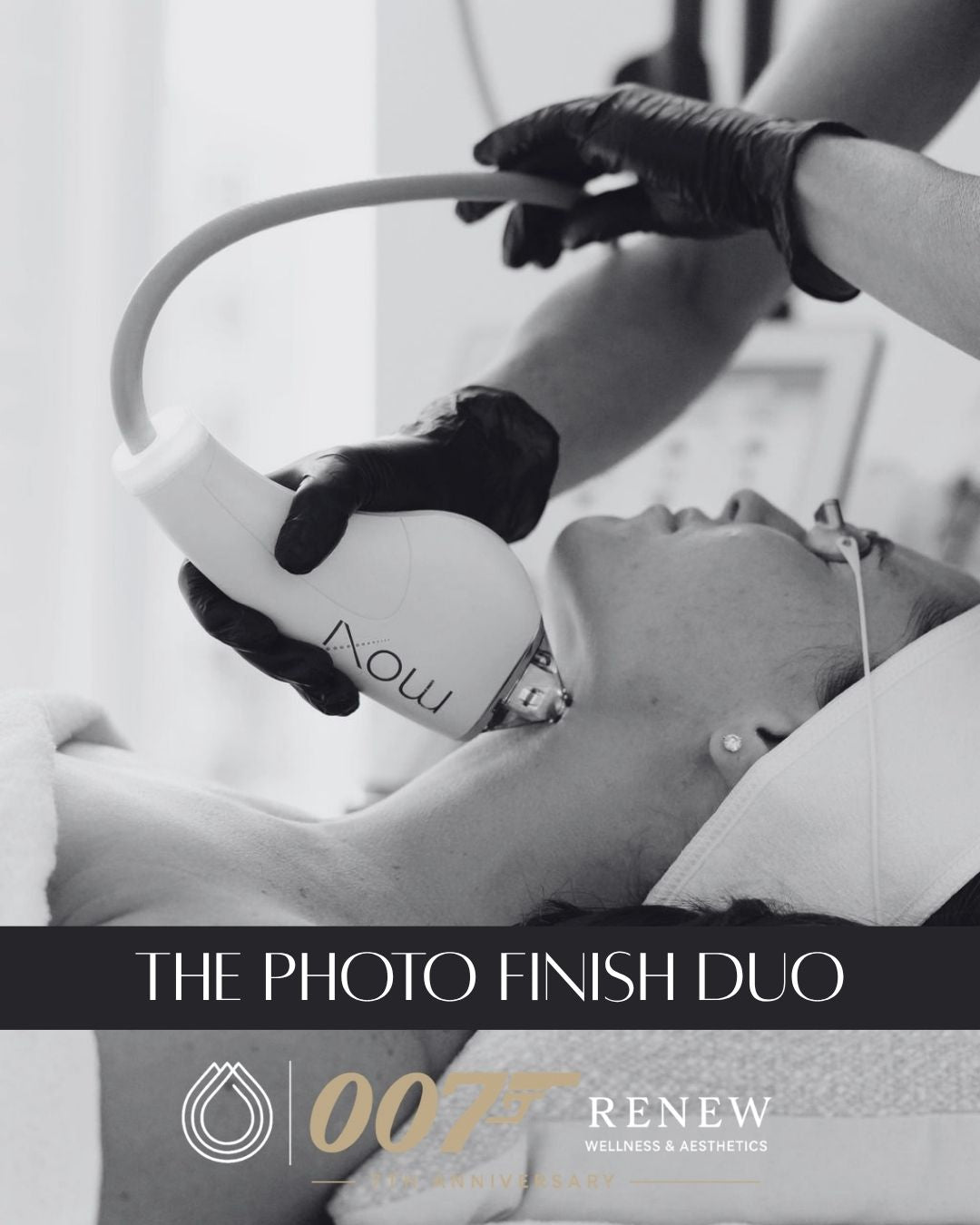 The Photo Finish Duo - BBL Hero + Moxi - Renew Wellness & Aesthetics 