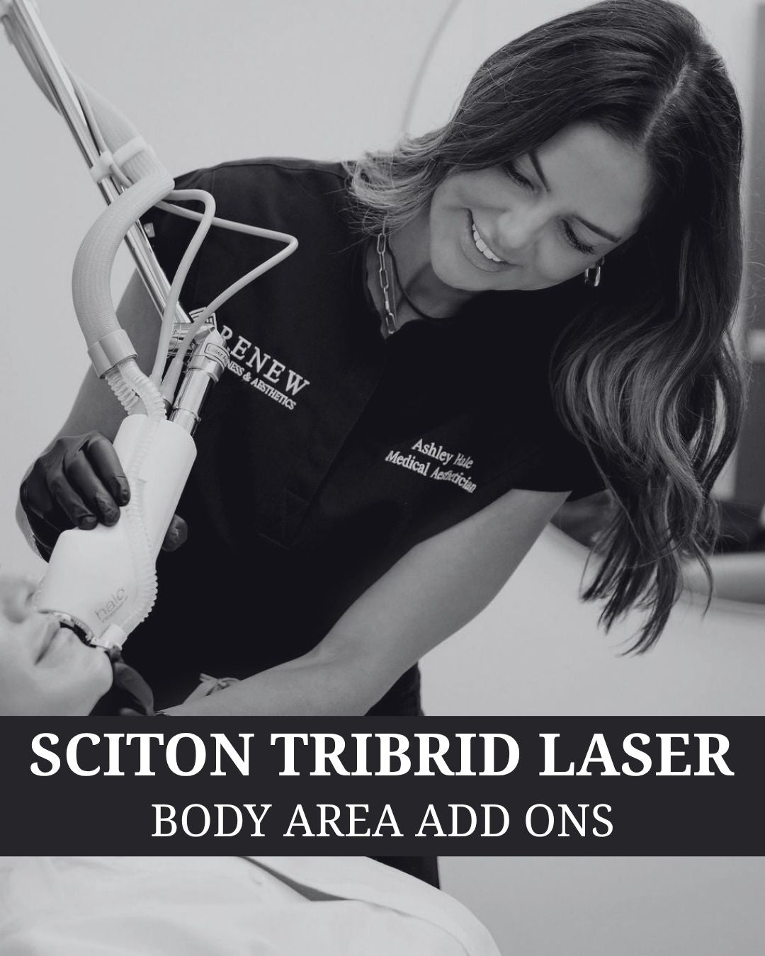 Sciton Tribrid Laser-Ultimate Skin Renewal ADD ON BODY AREAS - Renew Wellness & Aesthetics 
