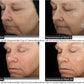 SkinMedica TNS Advanced+ SerumAnti - Aging - Renew Wellness & Aesthetics