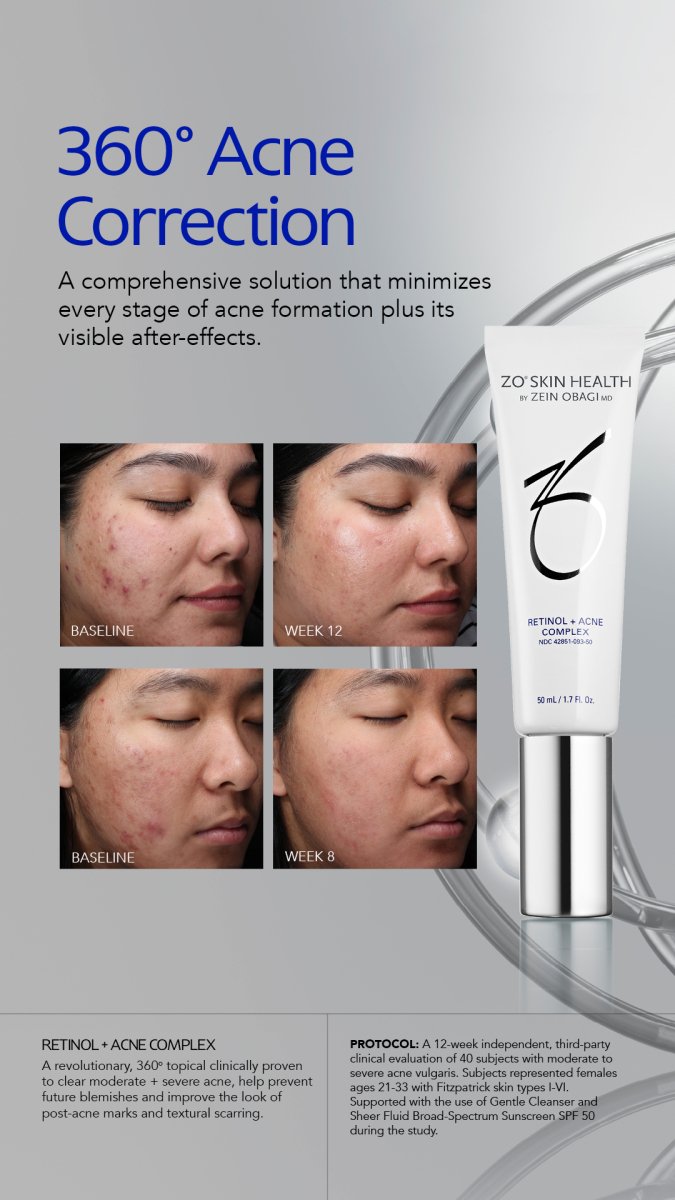 ZO Skin Health Retinol + Acne ComplexAcne Treatment - Renew Wellness & Aesthetics